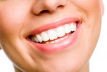 white teeth.jpg